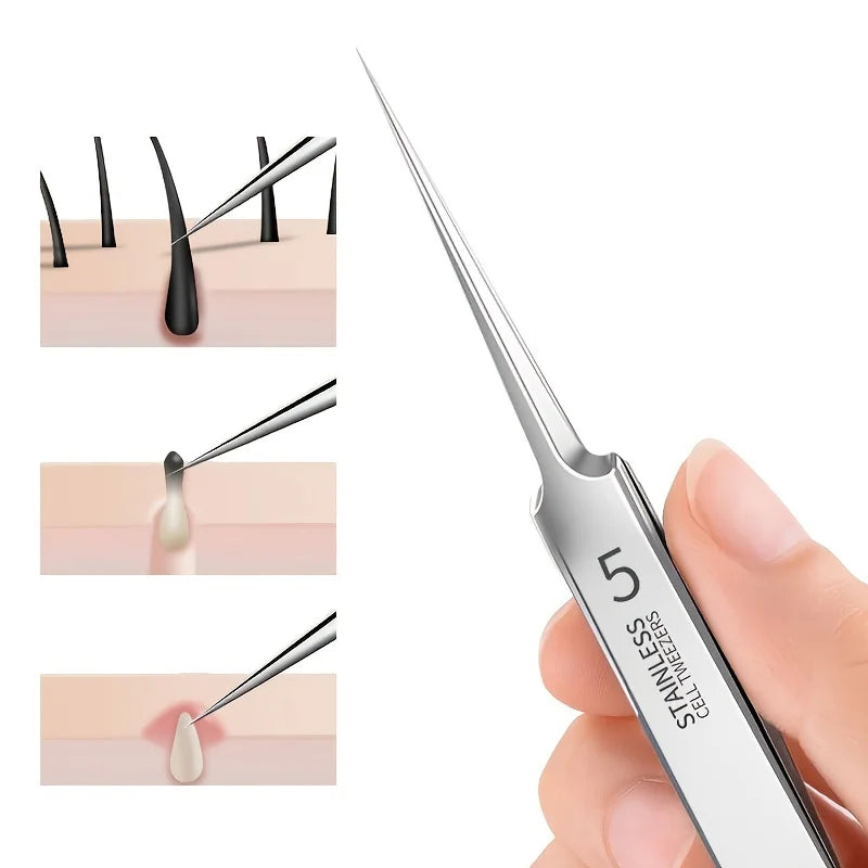 Ultra-Fine Acne Blackhead Clip Tweezers