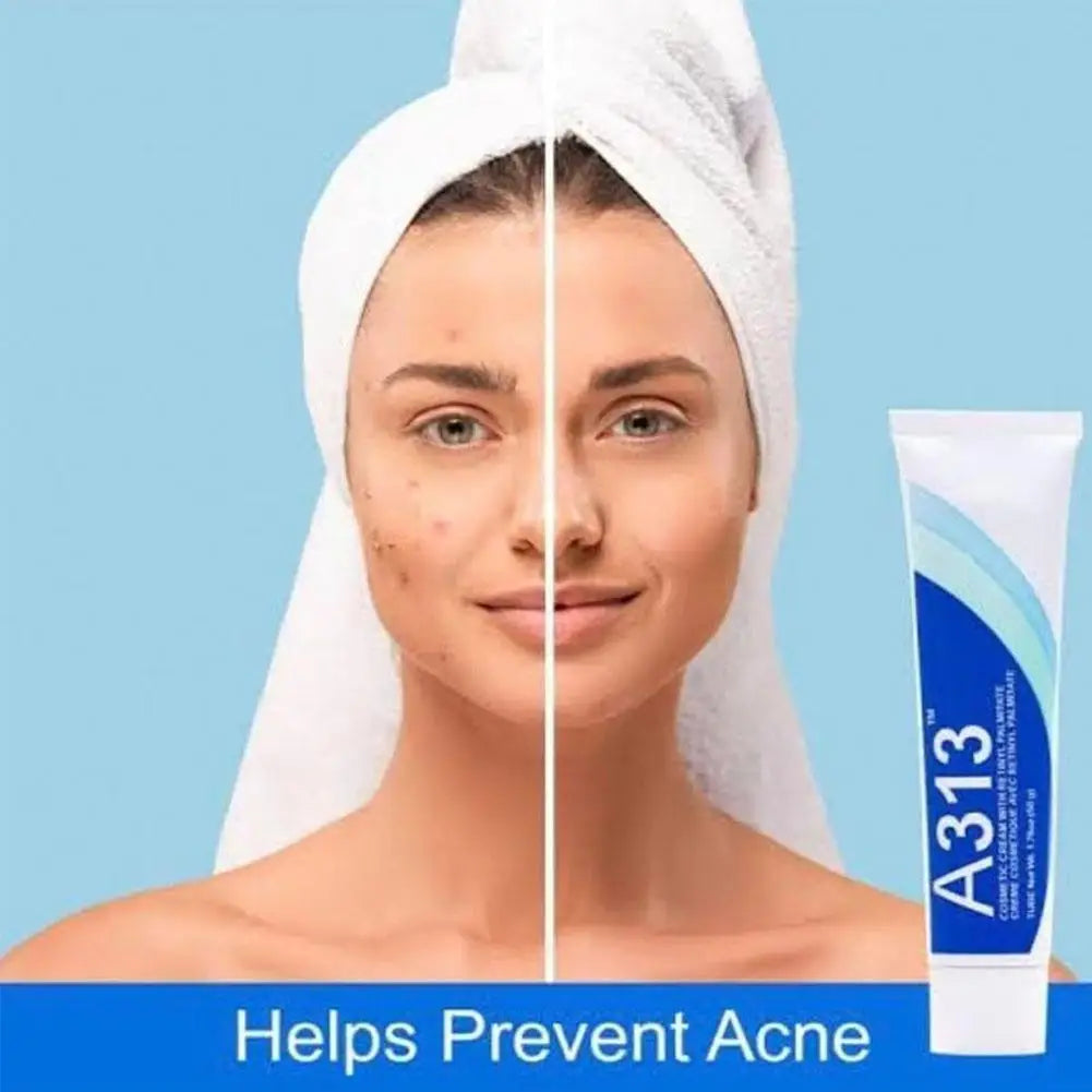 A313 Retinol Pommade Vitamin A Face Cream