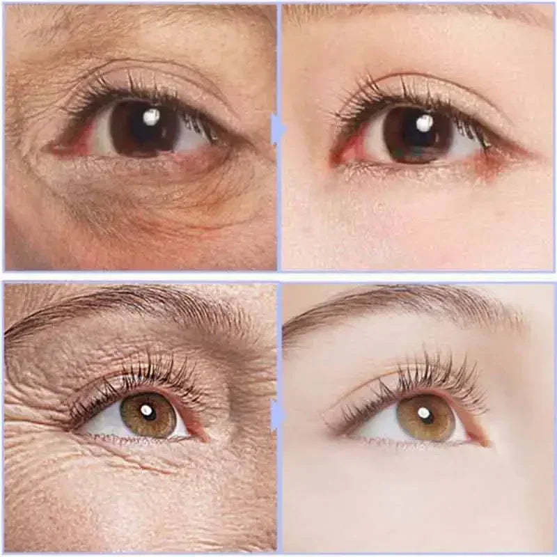 Instant Eye Cream For Anti Aging Dark Circles Bags