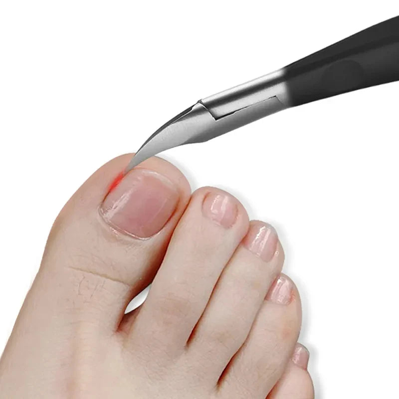 Ingrown Toenail Nippers