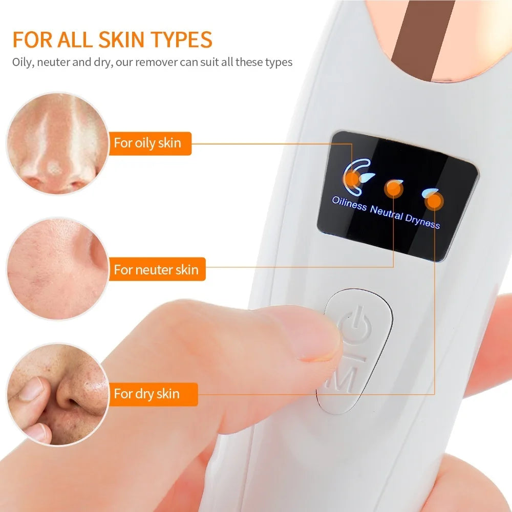 Vacuum Nose Blackhead Remover