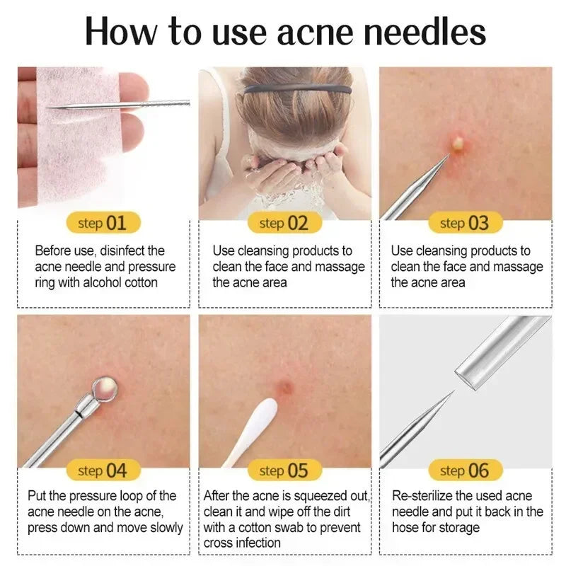 1/11Pcs Acne Pimples Blackhead Remover Clip Ultra-fine Tweezers