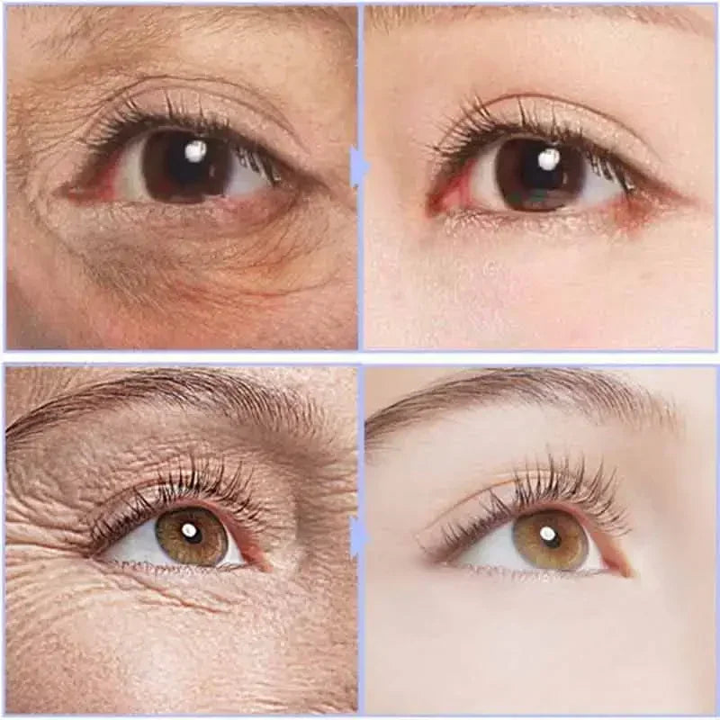 Instant Eye Cream For Anti Aging Dark Circles Bags