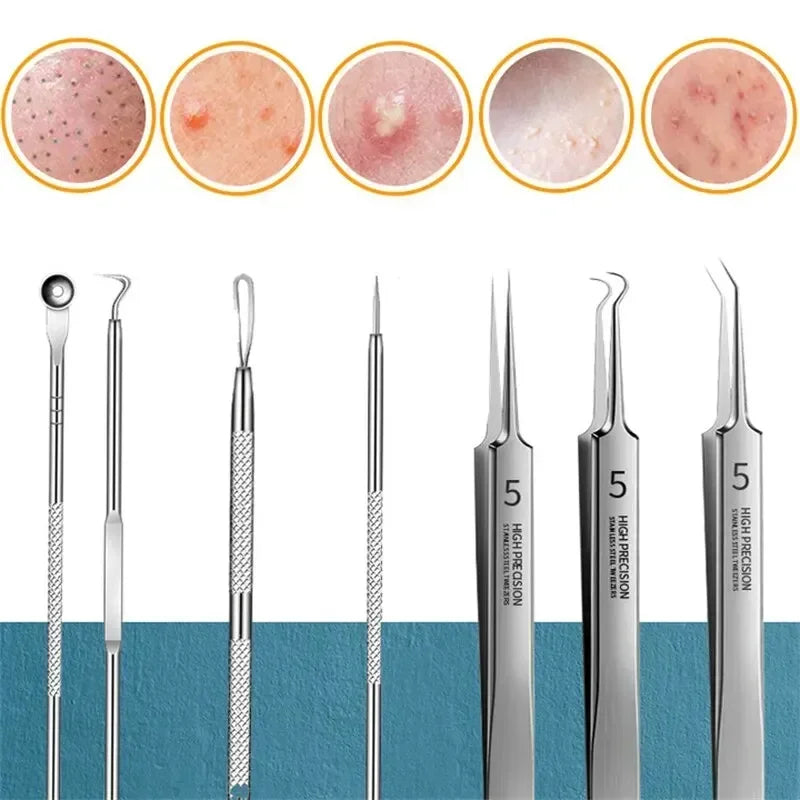 1/11Pcs Acne Pimples Blackhead Remover Clip Ultra-fine Tweezers