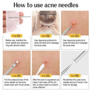 1/11Pcs Acne Pimples Blackhead Remover Clip Ultra-fine Tweezers