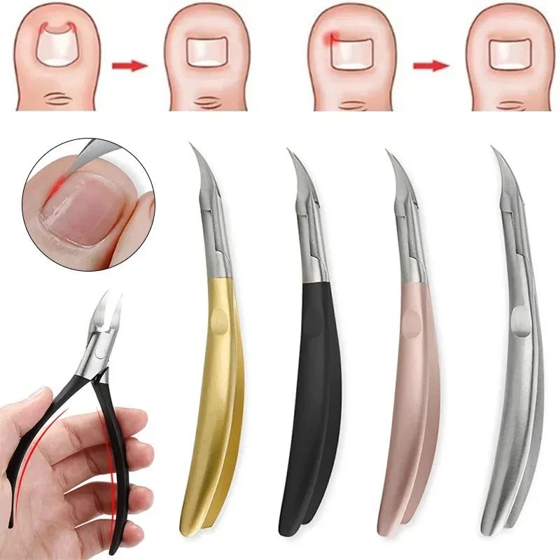 Ingrown Toenail Nippers