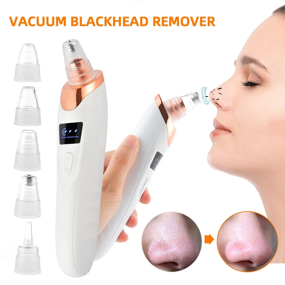Vacuum Nose Blackhead Remover