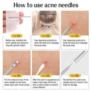 1/11Pcs Acne Pimples Blackhead Remover Clip Ultra-fine Tweezers