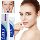 A313 Retinol Pommade Vitamin A Face Cream