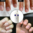 120lm Nail Cuticle Remover