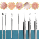1/11Pcs Acne Pimples Blackhead Remover Clip Ultra-fine Tweezers